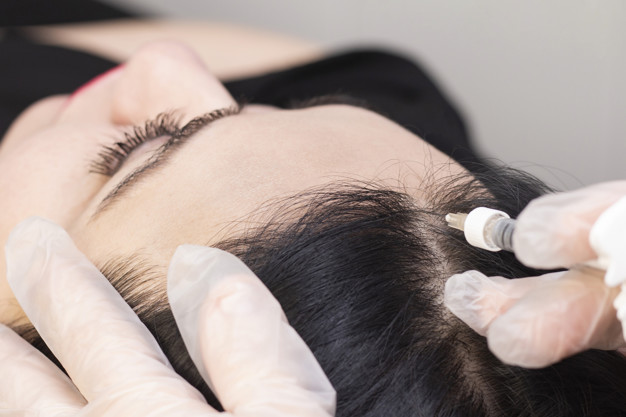 Hair Regrowth Treatments - Abby Medical Laser Centre